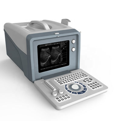品質  Ultrasound laptop diagnostic ultrasound machine /black and white ultrasound scanner with 15 inch LCD screen 工場