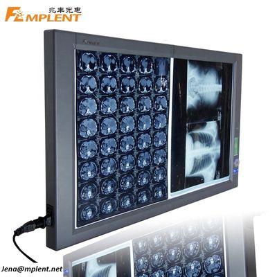 品質  Super Bright Digital Dual General Film Medical Negatoscope LED X Ray Viewer 工場