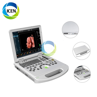 PRO China 3D 4D 5d metal laptop color doppler handheld scanner usg 4d machine ultrasound IN-AL5