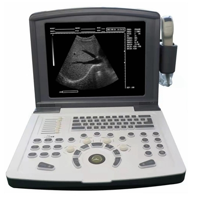 Full Metal Premium Digital Laptop Ultrasound Scanner Machine